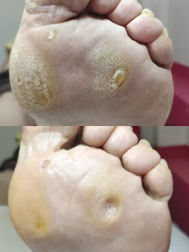 La belle podologia i kosmetologia